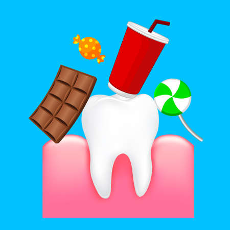 Effects of sugar to teeth. Dental care concept. Sweet food as an acid cauaing bacteria and molar cavity. Illustration.のイラスト素材