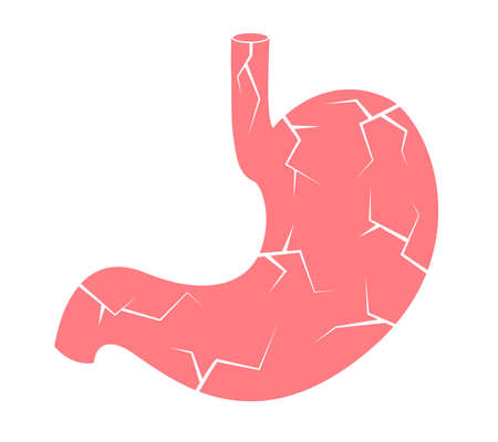 Damage stomach. Unhealthy stomach. Health care concept. Vector illustration.のイラスト素材