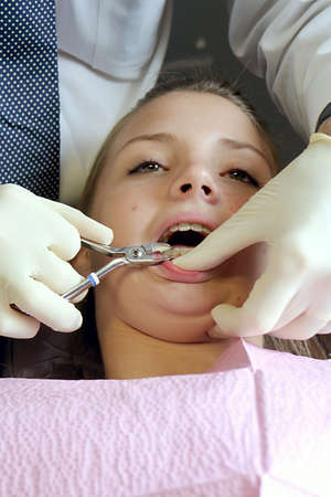 Teenage girl having braces removedの写真素材