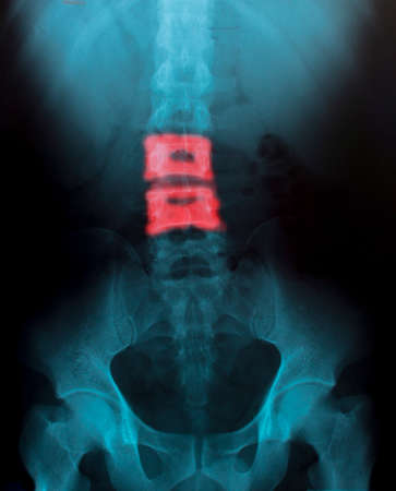 X-Ray Image Of Human  for a medical diagnosisの写真素材