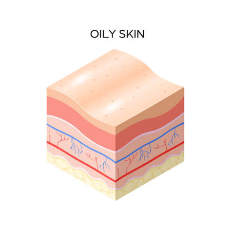 oily skin cross-section of human skin layers structure skincare medical concept flat vector illustrationのイラスト素材