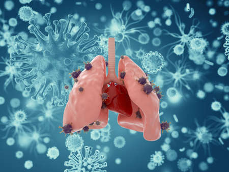 Viruses cell microbiology inflected in lugs,coronavirus conceptの写真素材
