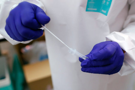 Corona virus pandemic. PCR Covid-19 test. France.