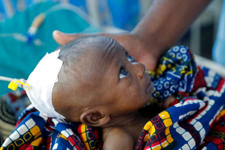 African hospital. Pediatric ward. Child in intensive care unit. Benign.のeditorial素材