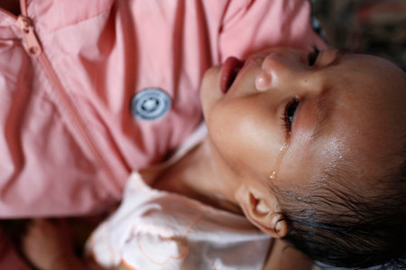 French NGO Chaine de lâEspoir. Children's pavilion. Child suffering from heart disease. Ho Chi Minh city. Vietnam.のeditorial素材