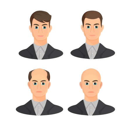 Alopecia concept. Set of heads showing the hairloss progress. Vector flat illustration.のイラスト素材