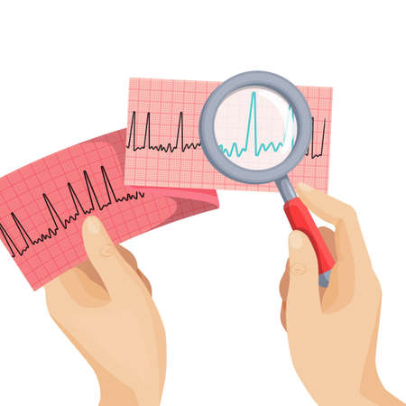 Look at atrial fibrillation through magnifying glass held by handのイラスト素材