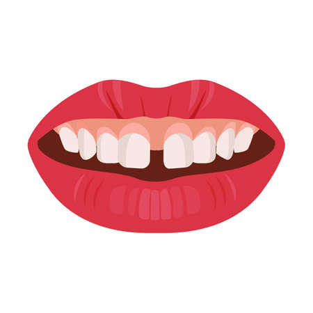 Gap teeth concept. Dental tooth problem and treatment. Dentistry care. Vectorのイラスト素材
