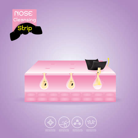Nose Cleansing Strip Vector, Concept Product  with Acne Problem on Nose.のイラスト素材