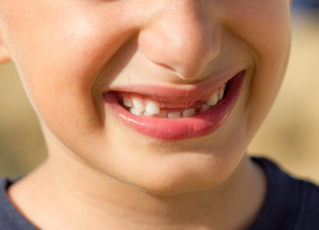 child smiling with no teeth