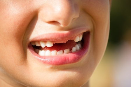 child smiling with no teethの写真素材