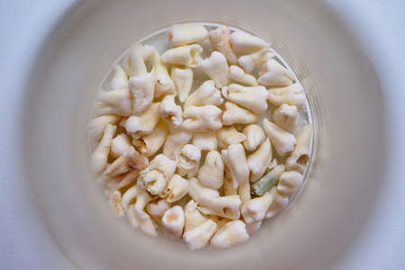 Plaster casts of human jaws. Teeth with decay and holes, decayed, in a large glass goblet on the table. Demonstration of anatomical features.の写真素材