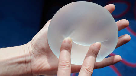 Silicone female breast implant is the main object of plastic surgery in human hands. Demonstration of the qualities of a medical objectの写真素材