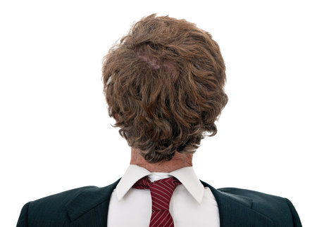 Confused, back to front businessman