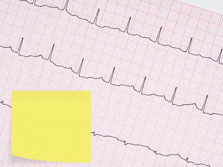 Healthy heart etc.