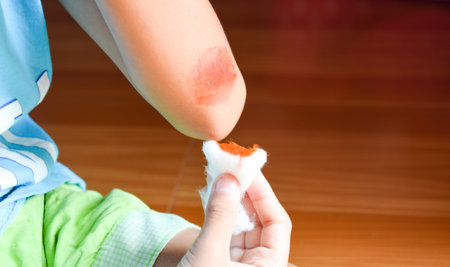 clean the wound handの写真素材