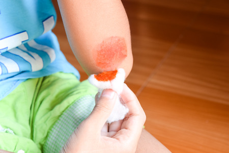 clean the wound handの写真素材