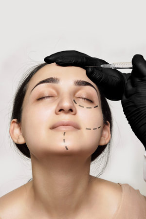 a womans face with lines drawn on her cheeks and eyebrows, being injected by a syline injection