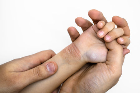 A man's hand holds a child's hand. Red dry skin food allergy. Close-up. Inspectionの写真素材