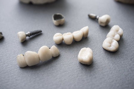 Ceramic dentures and crowns on gray background. Top view on set of single dentures and dental...