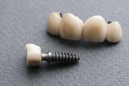 Single denture and dental crown on gray close-up. Front view on set of false teeth. Prototypes of dentures on gray backroundの写真素材