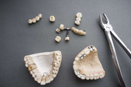 Dental prosthesis equipment flat lay. Top view on two gypsum jaws, dentures and dental crowns and bone forceps on gray background. Tools for dental prosthesis practiceの写真素材
