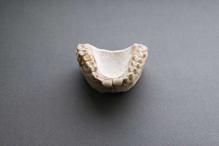 Plaster jaw with two dentures on gray background flat lay. Dentist work equipment for selection right dentures for patient.の写真素材