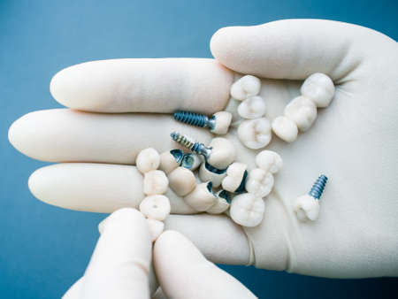 Surgical orthodontics. Teeth reconstruction and prosthodontics. Closeup of dentist hand holding ceramic dental implants.の写真素材