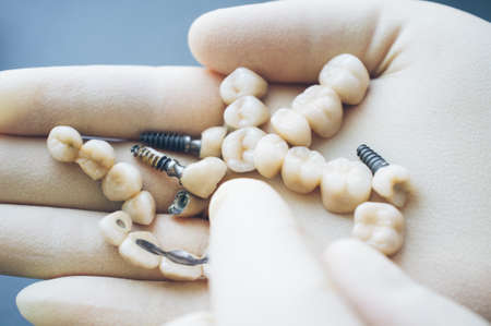 Stomatology and healthcare. Dentist choosing dentures in his hands.