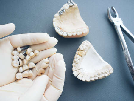 Dental prosthesis equipment and tools. Two gypsum jaws dentures crowns and bone forceps on gray background.の写真素材