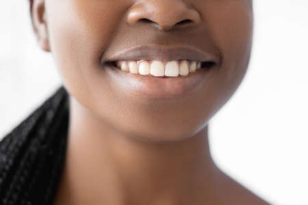 Healthy smile. Dental care. Dentistry wellness. Oral hygiene. Unrecognizable closeup of fresh young African woman face with wide grin perfect clean teeth isolated on white.の写真素材