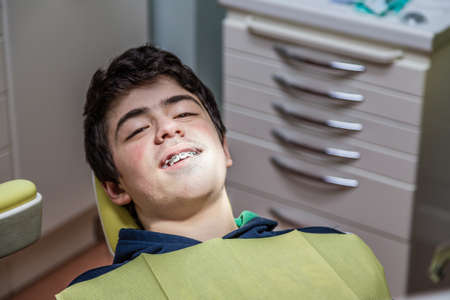 Caucasian teenager with acne skin lying on the dentist chair is smiling showing bracesの写真素材