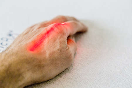 physiotherapy treatment with laser on caucasian hand