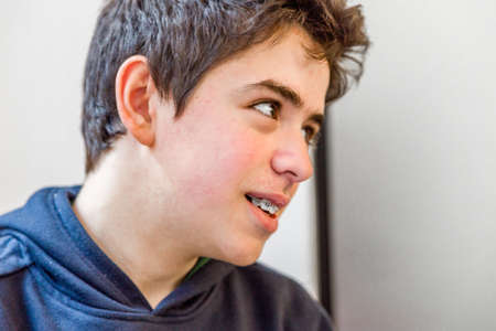 caucasian boy happy and smiling with braces on teeth, boy looking to his leftの写真素材