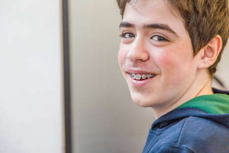 caucasian boy happy and smiling with braces on teethの写真素材