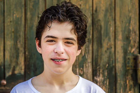 teenager with acne skin smiling while showing bracesの写真素材