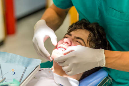 guy on the dentist chair while the orthodontist is checking the brackets of edgewise dental applianceの写真素材