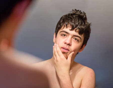 teen with braces checking acne skin in mirrorの写真素材