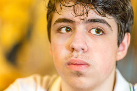 pensive boy with acne skin looking sideways