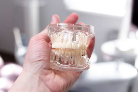 Mock up jaw with teeth holds in hand