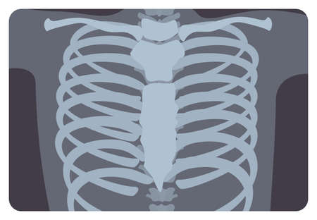 Radiograph, X-radiation picture or X-ray image of rib or thoracic cage formed by vertebral column and sternum. Medical radiography and human skeletal system. Flat monochrome vector illustration.のイラスト素材