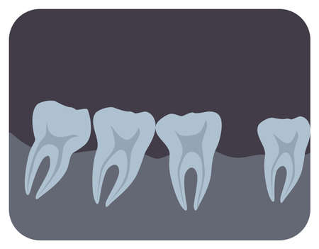 Intraoral radiograph of human teeth and gingiva. Dental x-ray picture or radiographic monitor image,...