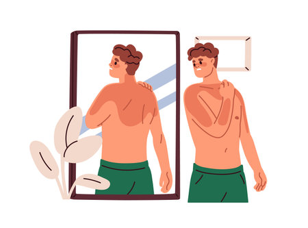 Man with reddish body after sun UV, looking at skin sunburns in mirror. Suntan burns problem on body. Sad person with burnt spots. Flat graphic vector illustration isolated on white backgroundのイラスト素材
