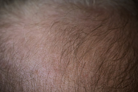 closeup shot of caucasian man with thinning hair problem
