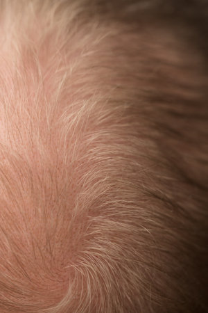 Macro shot of hair loss problem of blonde man hair closeup