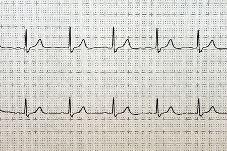Close up of ECG  electrocardiogram  paper の写真素材
