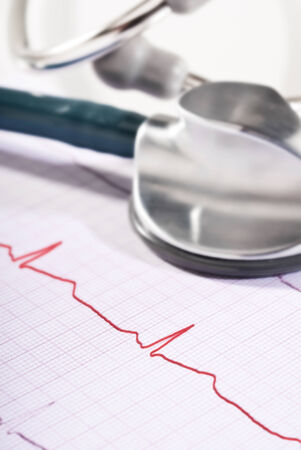 Stethoscope lying on the printout of an ECG の写真素材