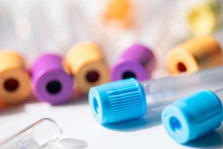 Various tubes for taking blood samplesの写真素材