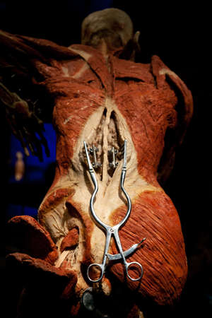 Body World is a museum that exhibits plastinated bodies.のeditorial素材
