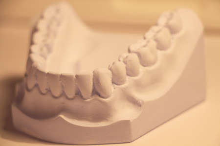 anterior view of dental cast made from blue stone plaster in orange lightの写真素材